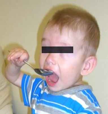 turner.ru артрогрипоз