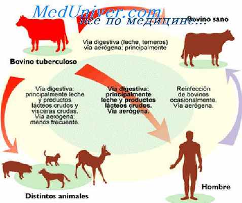 Эпидемиология туберкулеза