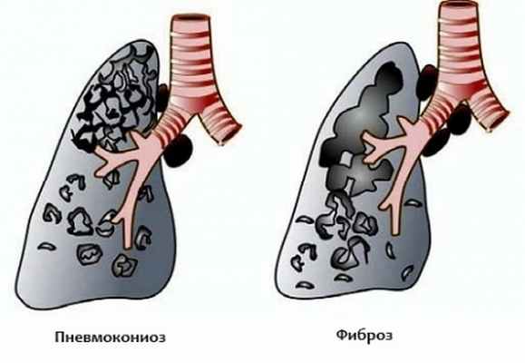 Необходимость аспирации воздуха на производстве