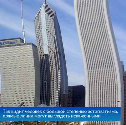 Зрение при астигматизме