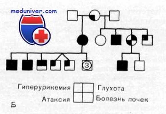почечная недостаточность с глухотой