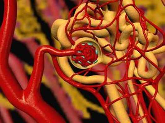 Атероэмболия почечных артерий