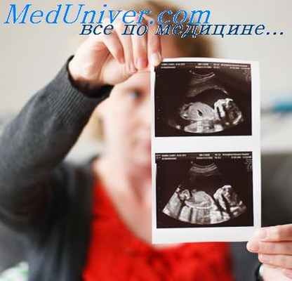 атрезия кишечника