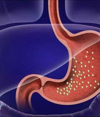 Фото Лечение атрофического гастрита