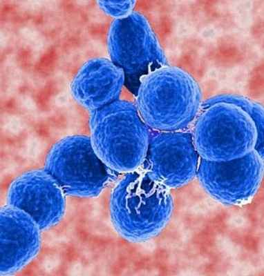 Фото Менингит у новорожденных