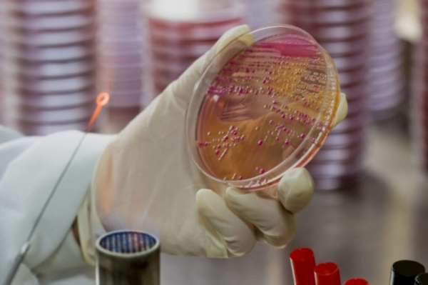 Бакпосев мочи на питательные среды