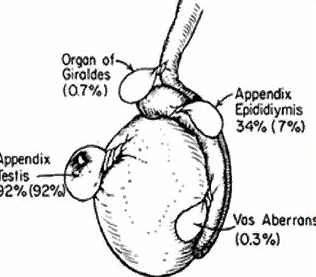 Перекрут гидатид