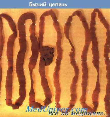 Бычий цепень