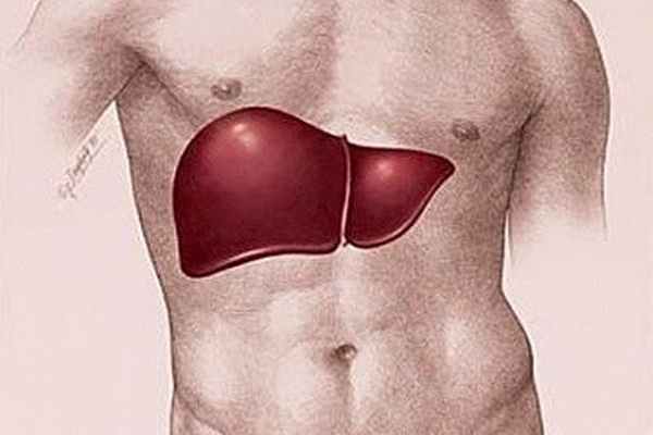 Фото Билиарный цирроз печени