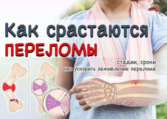 Регенерация кости (заживление переломов): стадии, сроки, условия ускорения заживления перелома