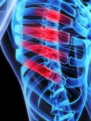 межреберный нерв симптомы и лечение