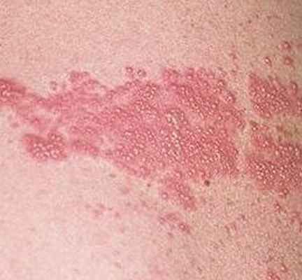 Причины боли в боку слева, справа и что с этим делать