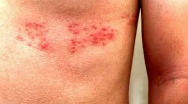 Причины боли в боку слева, справа и что с этим делать