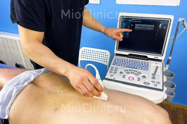 Диагностика миофасциального синдрома