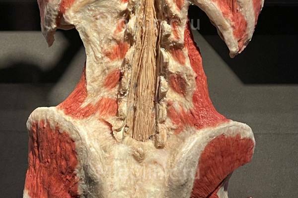 Усугубляющие факторы миофасциального синдрома