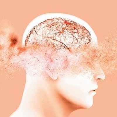 Болезнь Альцгеймера