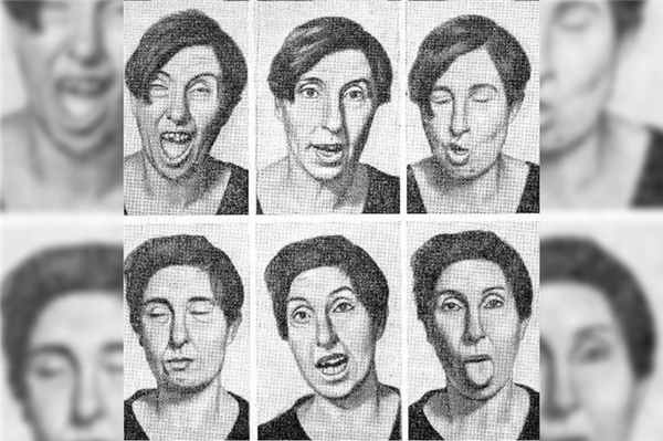 Хорея Гентингтона