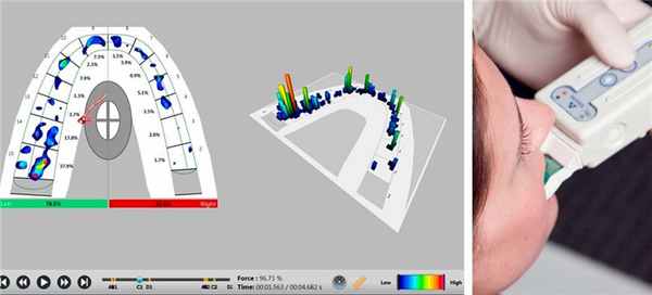 Завершение диагностики T-skan