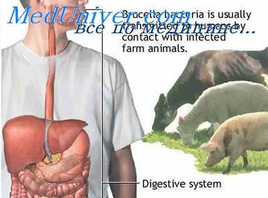 бруцеллез