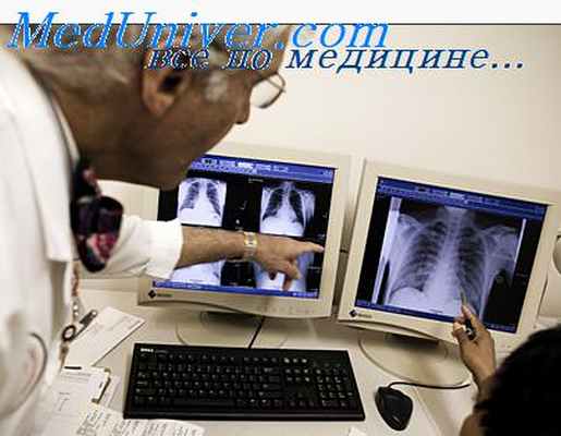 диссеминированный туберкулез