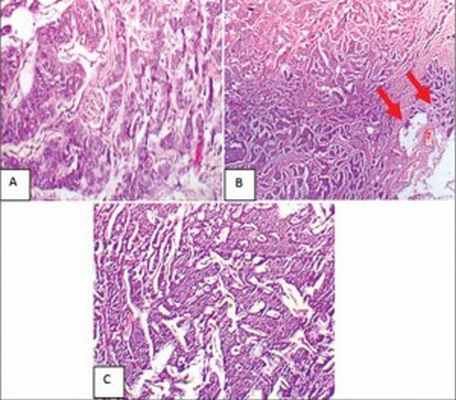 2Без имени-1