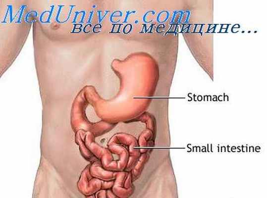 бугристость подвздошной кишки