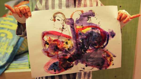 Ребенок с синдромом бабочки