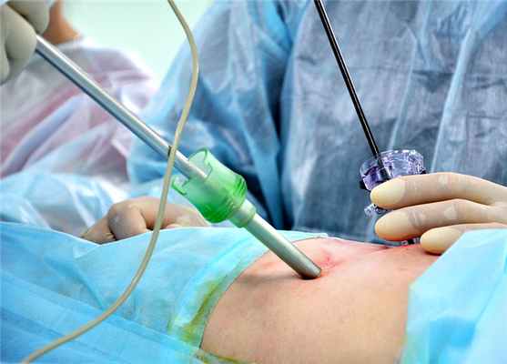 Видеоторакоскопия (ВТС) в Ростовской областной клинической больнице