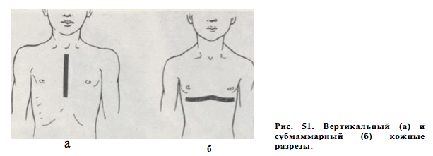 вертикальные и субмаммарные кожные разрезы