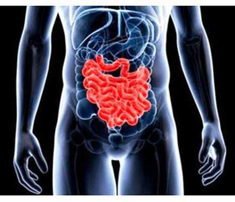 Клинический случай лечения сегментарного мезентериального тромбоза с картиной острого желудочно-кишечного кровотечения