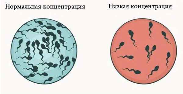 спермограмма