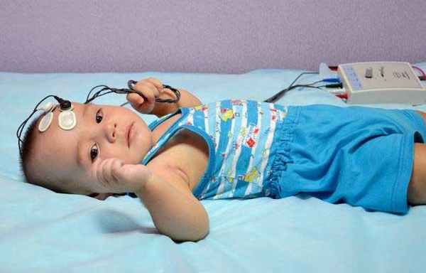 Слуховая нейропатия