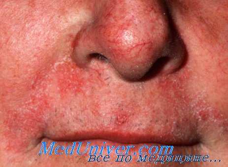 повреждения кожи