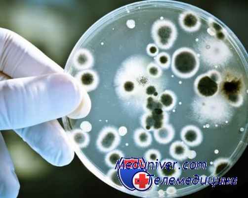 вирусный гепатит