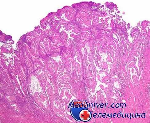 цитологическое исследование желудка