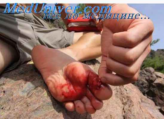 цитология раны