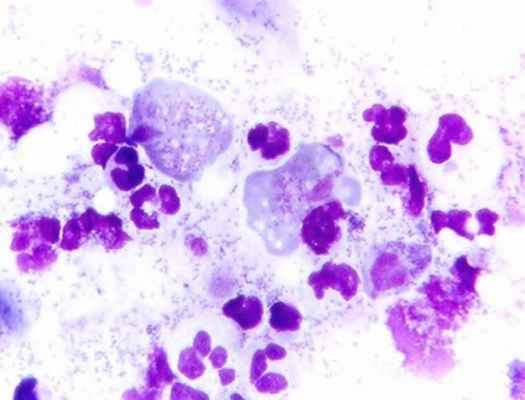 ЦИТОЛОГИЧЕСКОЕ ИССЛЕДОВАНИЕ КОЖНЫХ МАЗКОВ-ОТПЕЧАТКОВ