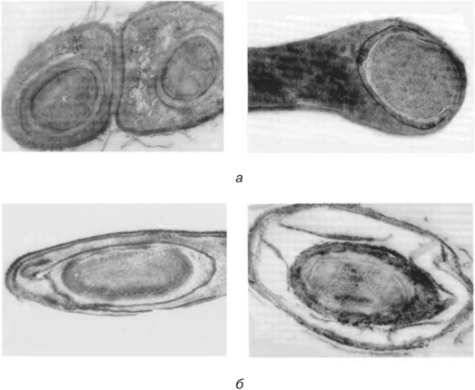 Электронные микрофотографии эндоспор