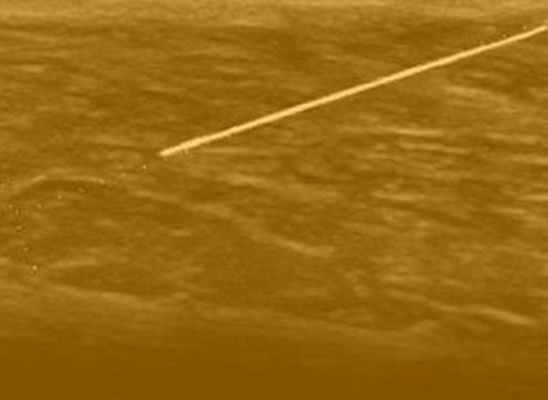 Помощь на месте