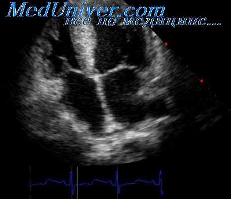 допплерография