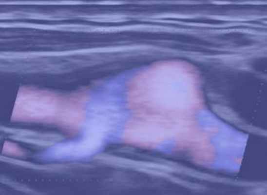 Ангиология