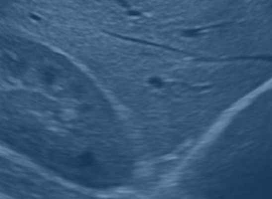 Общая радиология