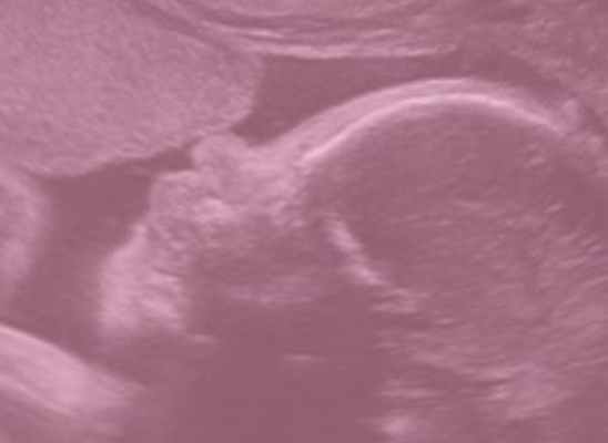 Акушерство