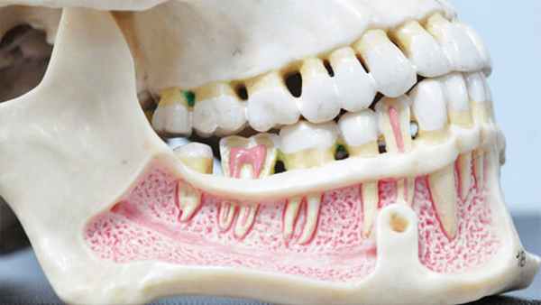 Дефекты нижней челюсти