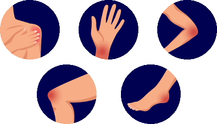 Болят пальцы, спина, колени, ступни при артрите