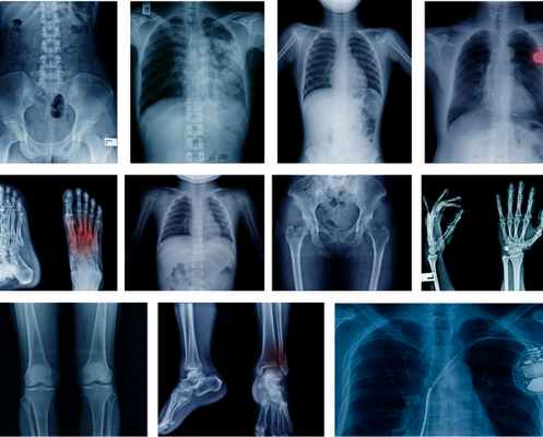 Рентгеновские снимки скелетного каркаса и костей