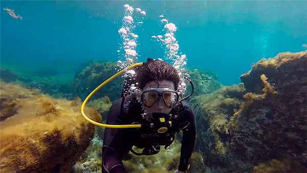 Декомпрессионная (кессонная) болезнь