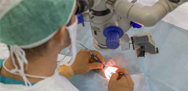 Операция удаления эпиретинальной мембраны