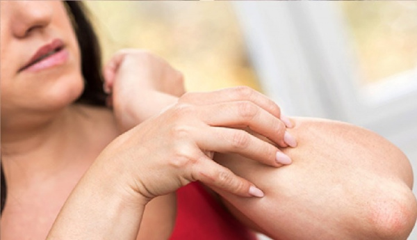 Дерматозойный бред