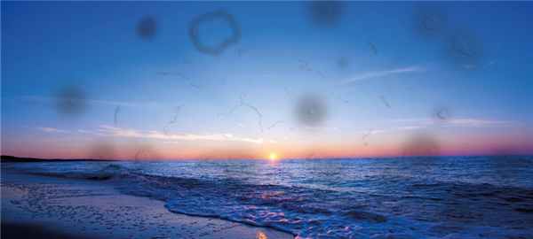 Деструкция стекловидного тела — 3Z